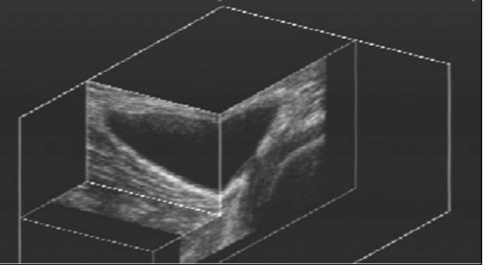3D ultrasonografické vyšetřování pohybového aparátu